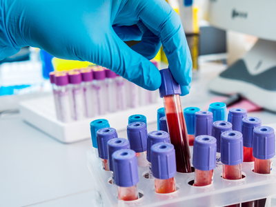 Photo of scientist moving blood test tubes.