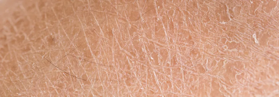 Photo of human skin.