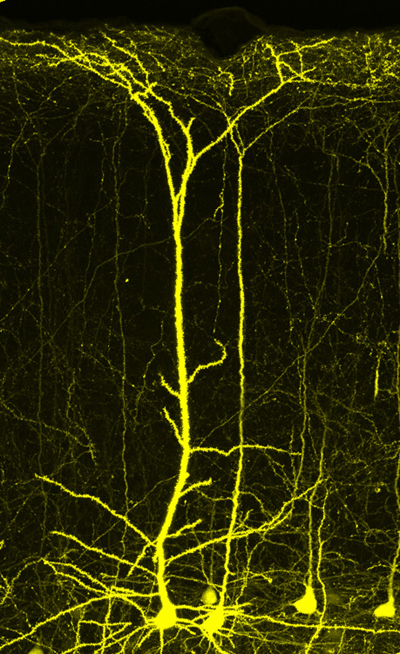 Image of neurons.