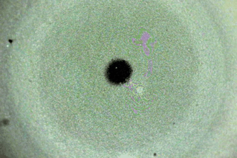 Photo of tear fluid being analyzed.