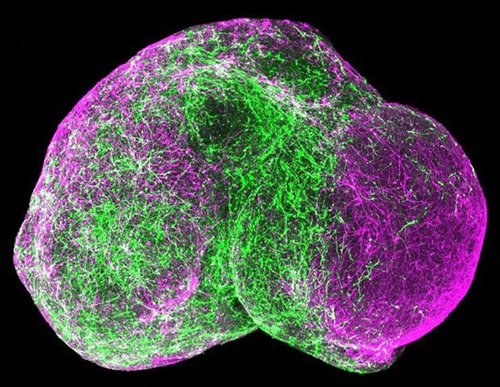 Photo showing two spheroids merging as neurons make connections, with one spheroid lit green and one in purple.