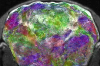  Cross-section MRI scan through a xenocortical mouse brain showing a map of estimated nerve-fiber pathways and directions. 