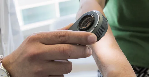 Photo of doctor using handheld dermatoscope device to examine a patient's skin.