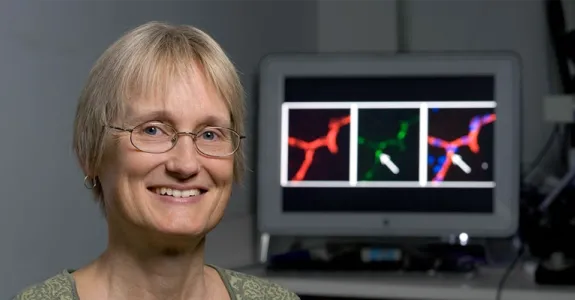 Photo of Dr. Katrin Andreasson in front of a computer monitor screen showing brain images.