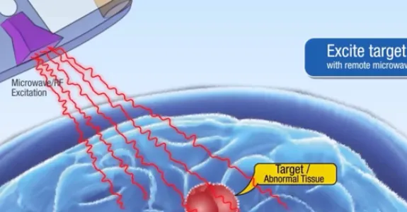 Screenshot from video demonstrating technology.