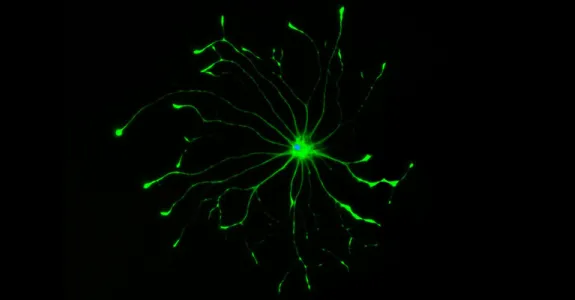 Image of an astrocyte cell lit up green.