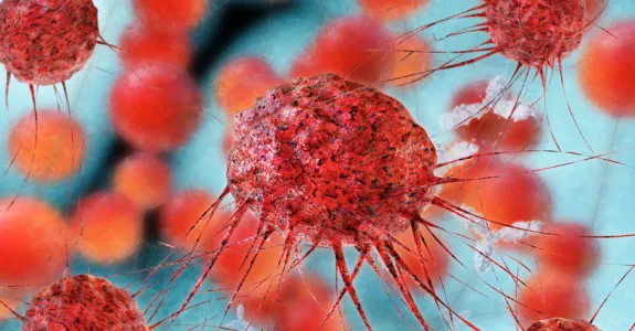 Graphic image of cancer cells.