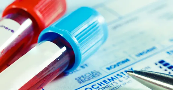 Photo of two blood sample tubes.