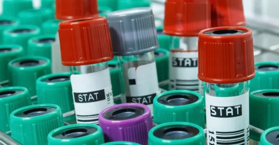 Photo of two blood sample tubes.