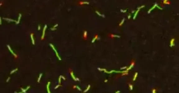Image of protein filaments on the surface of a microscope coverslip.