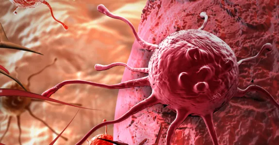 Graphic image of tumor cells.