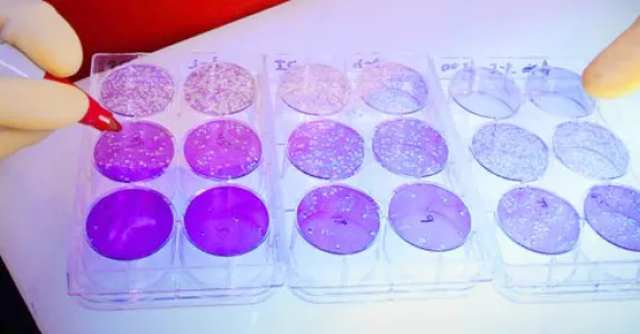Photo of scientist counting viral plaques at CDC.