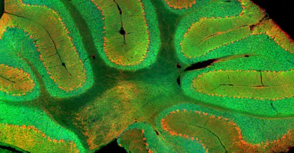 Image of cerebellum with granule cells demarcated in green.