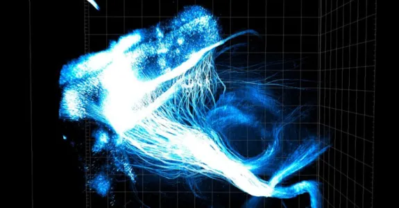 3D CLARITY image shows neural connections from the prefrontal cortex across an entire transparent mouse brain.