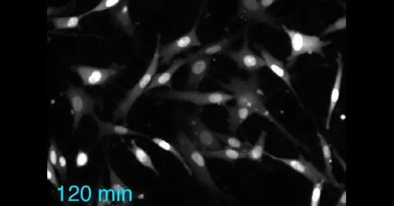 Image from video of cells being stimulated to activate kinases.