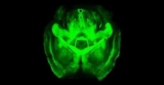 Graphic of a clarified brain image