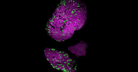 Image depicting optogenetic control of nerves.