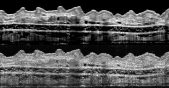 Image of two scans of the same scan of a mouse's ear, with the bottom having significantly finer resolution.