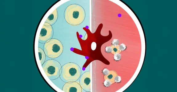Graphic image of a circle with two sides, the left side blue with cells in it, the right side red with cells being attacked by T cells. A large amorphous red cell sits on the center line of hte circle with purple dots on the blue half-circle side.