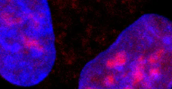 Magnified image of cells visualized with ATAC-seq, with cells lit up in blue, pink, and purple on dark background.