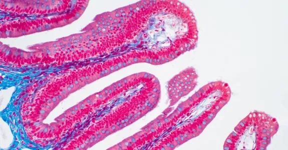 Image of villi cells in bright pink and blue on a white background.