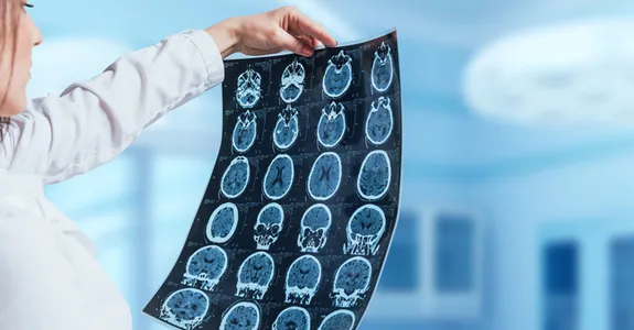 Photo of a female doctor holding up a set of X-rays of a patient's head.