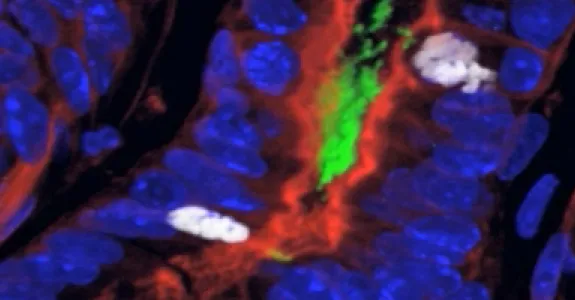 Image of stomach tissue.