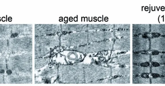 Compilation of 3 labeled images: first image is of "young muscle", showing grid of interconnected fibers; second is of "aged muscle", which shows damage in the center where fibers have disconnected and there are gaps; third image is "rejuvenated muscle", which shows more tightly woven structure similar to the young muscle.