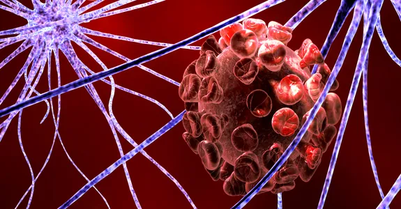 Graphic of cells affected by immunodeficiency disease.