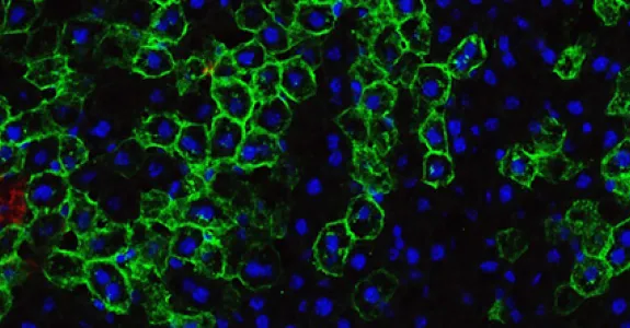 Photo of liver stem cells.