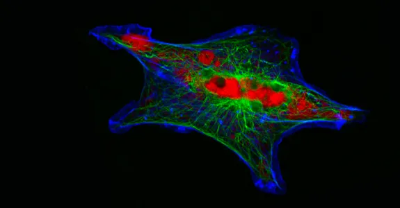 Fluorescent image of a wide, almost star-shaped cell on a black background, with the border of the cell in bright blue, and its interior showing concetrated red bulbs and fibrous green sections around them.