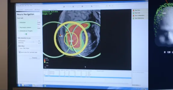 Images of work on brain mapping.