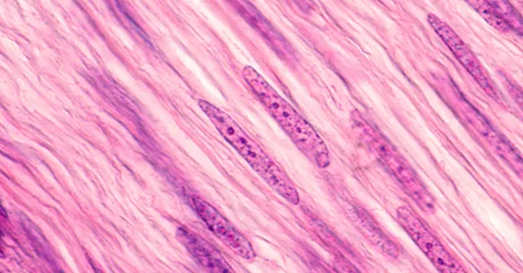 Image of muscle cells showing how long and striated they are.