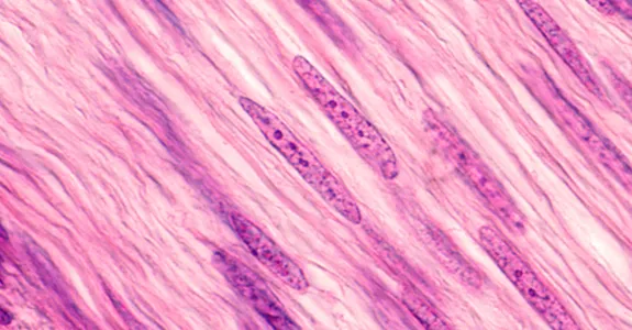 Image of smooth muscle cells in pink, with long nuclei showing darker purple.