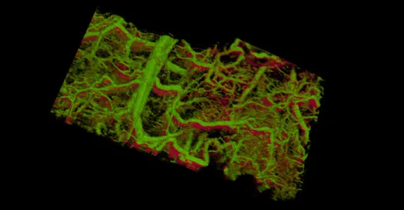 Graphic of blood vessels in mouse ear.