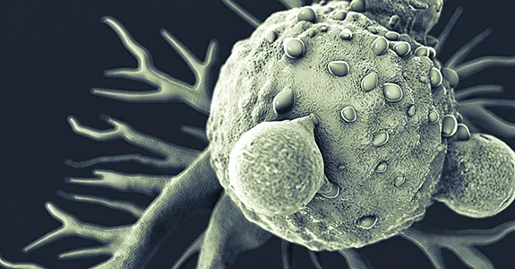 Graphic image of T lymphocytes and cancer cell.