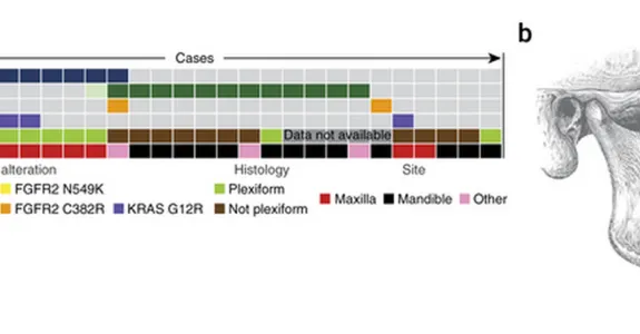 Figure of mutation frequency, distribution and relationship with pathological features from publication in Nature Genetics.