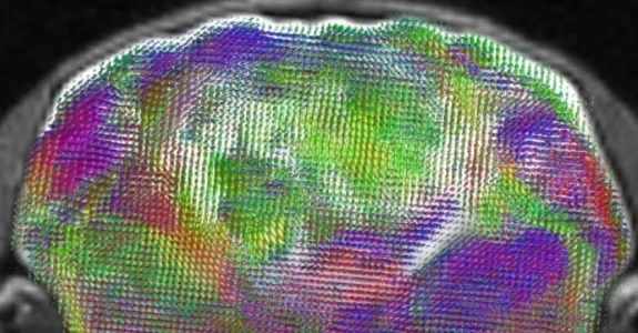  Cross-section MRI scan through a xenocortical mouse brain showing a map of estimated nerve-fiber pathways and directions. 