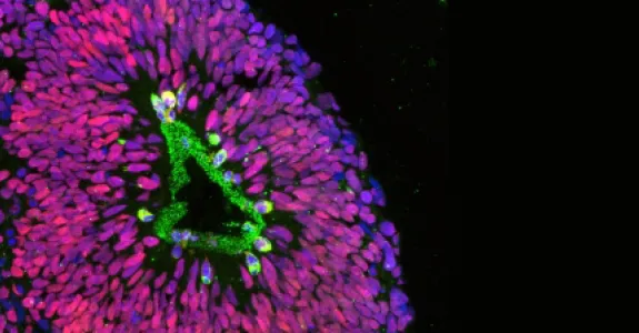 A cross section of a human cortical spheroid.