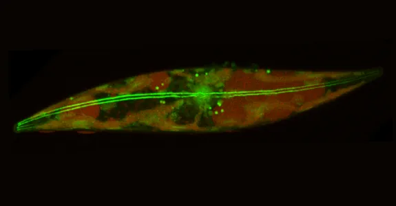 Image of a slender cell on a black background.