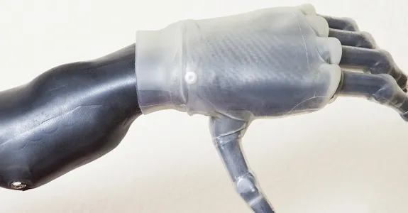 Photo of a prosthetic hand.