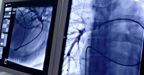 Photo of radiological images on computer screen.