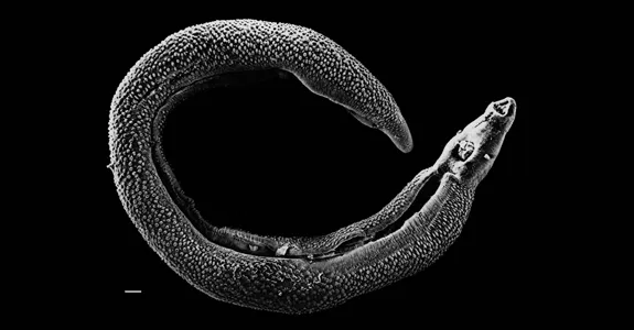 Photo of parasitic worm.