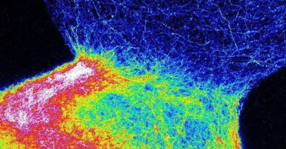 Image of a model nerve circuit created by the Pasca lab in a dish, depicting two bodies joined together, one lit up in many colors with activity and one dark blue. Both are striated with different cells.