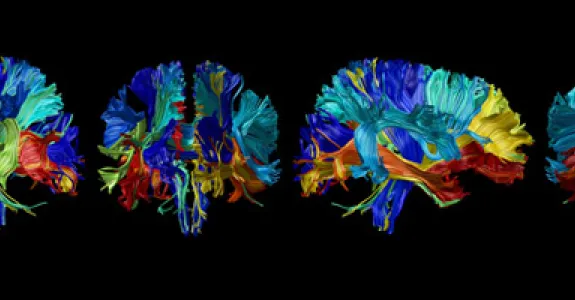 Graphic indicating changes in brain composition with age.