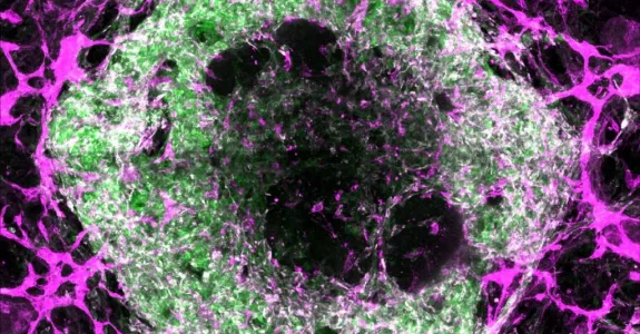 Image of a green and white cell surrounded by a web of purple lines.