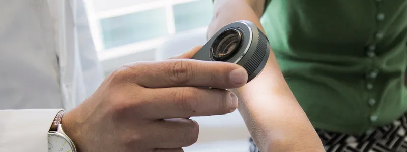 Photo of doctor using handheld dermatoscope device to examine a patient's skin.