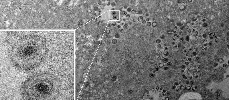 Microscope image of virus, showing virus cells in lighter gray against other cells.