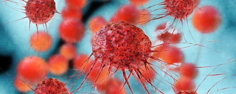 Graphic image of cancer cells.