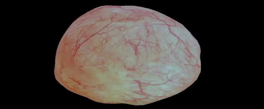Screenshot from video of 3D bladder reconstruction.